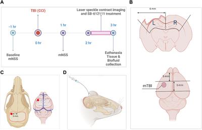 The Nociceptin/Orphanin FQ peptide receptor antagonist, SB-612111, improves cerebral blood flow in a rat model of traumatic brain injury